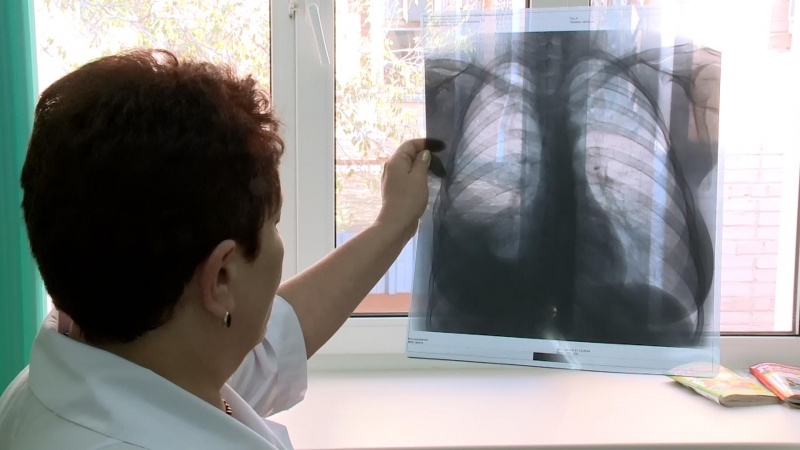 Как выявить туберкулез на ранних стадиях?